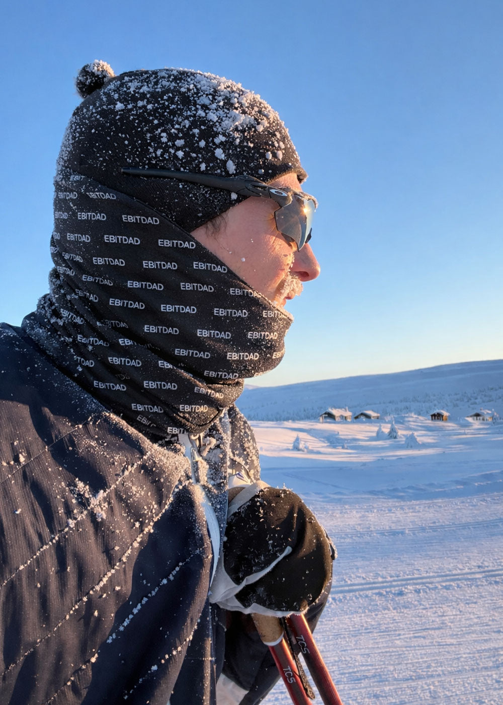 'EBITDAD' teknisk hals